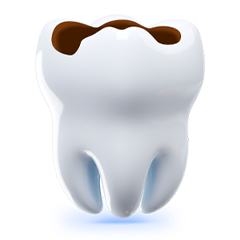 incrustatiile dentare